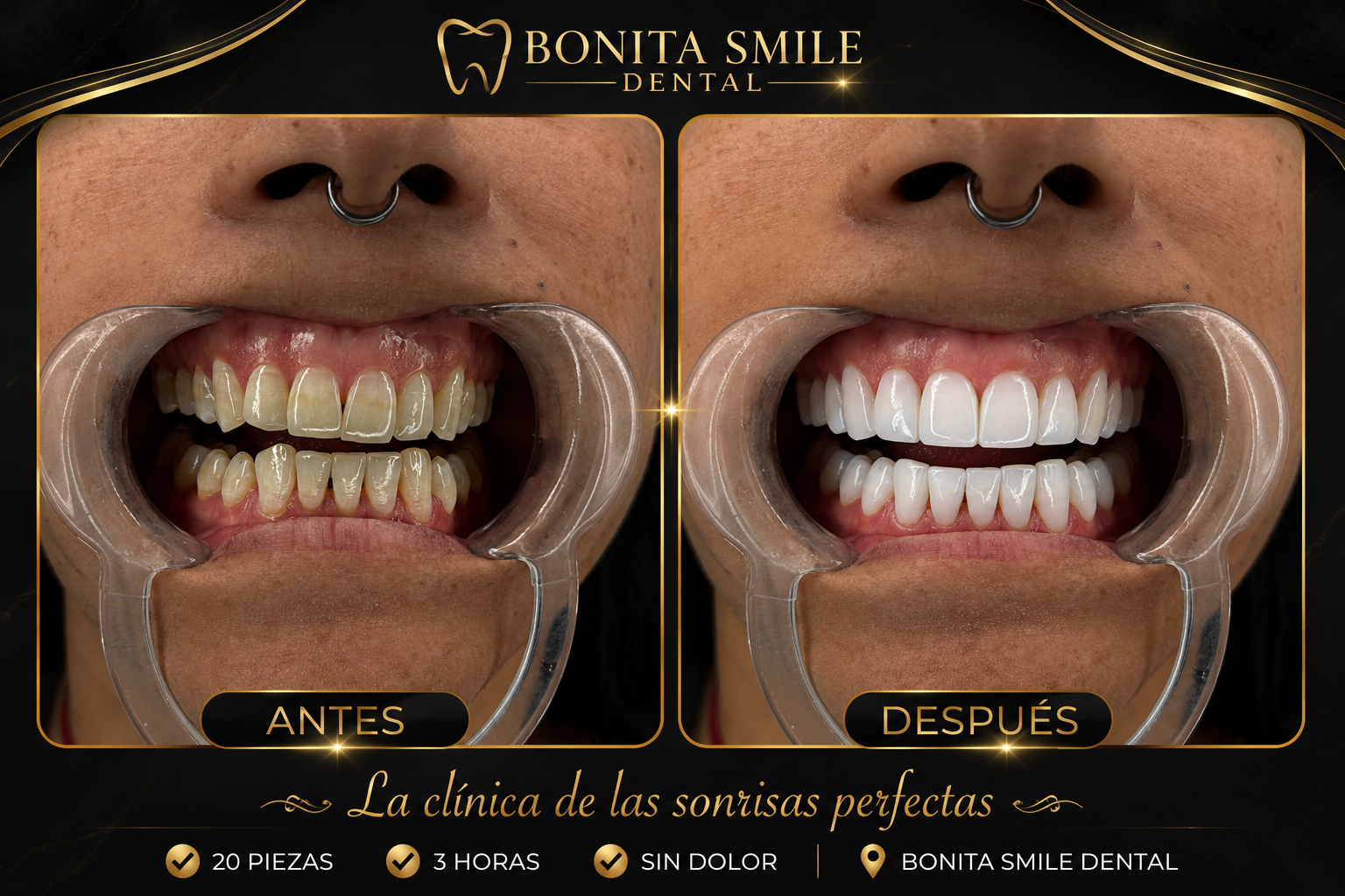 Diseño integral — 20 piezas — Antes y después
